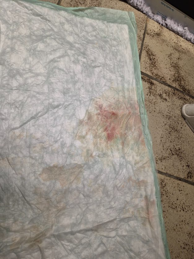 Blut im Urin